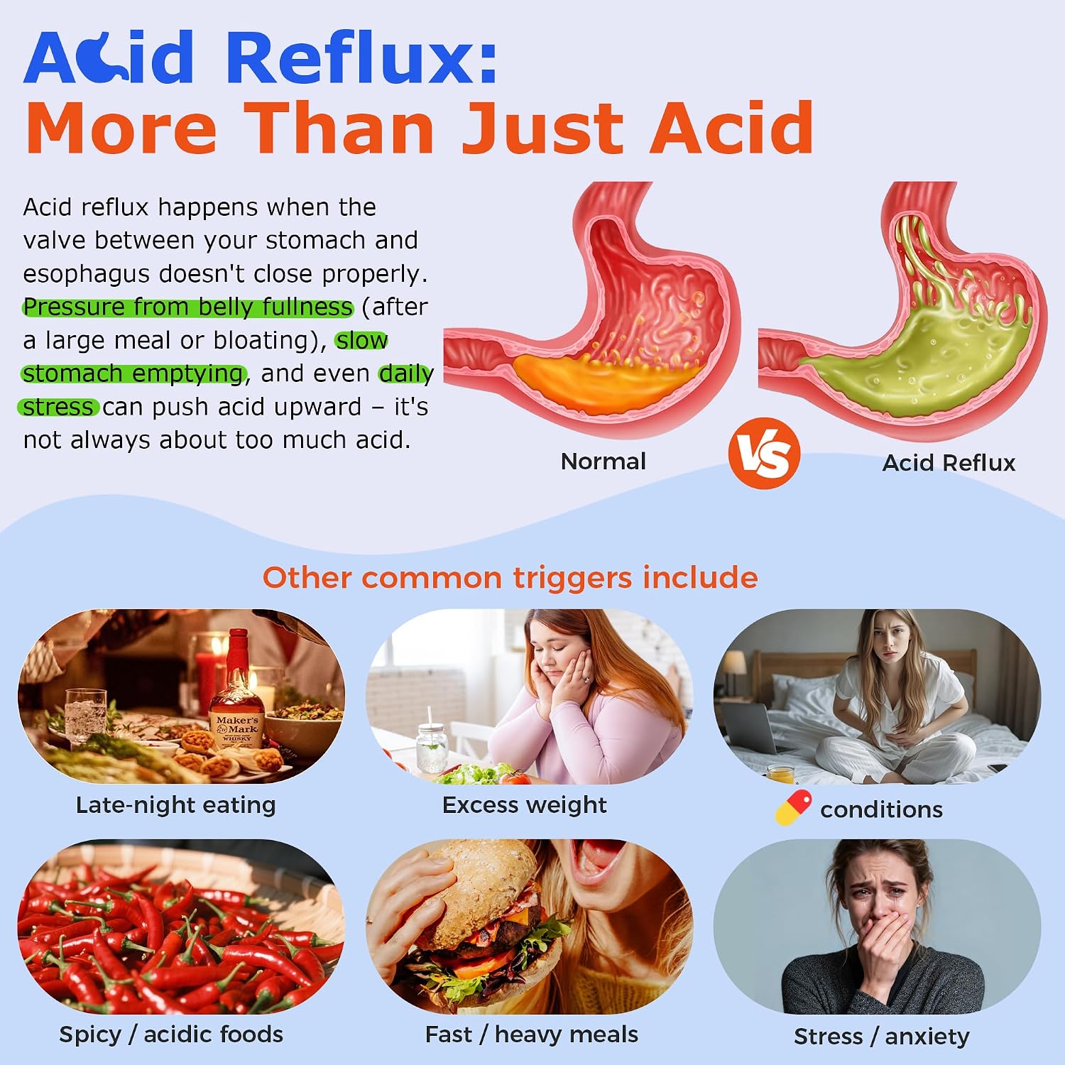 Alginate Raft vs. Antacids: Two Completely Different Approaches to Acid Reflux