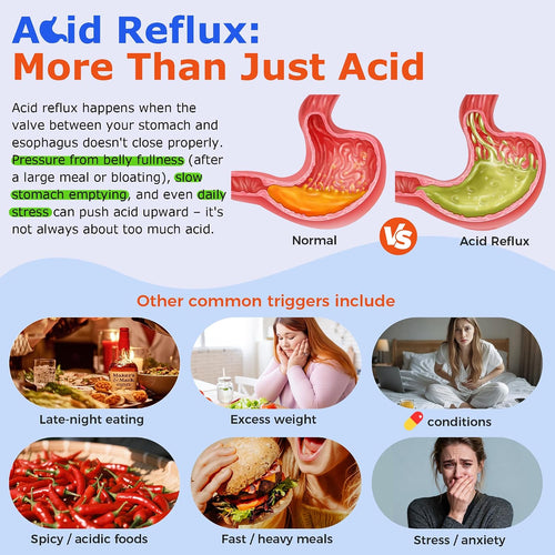 acid reflux